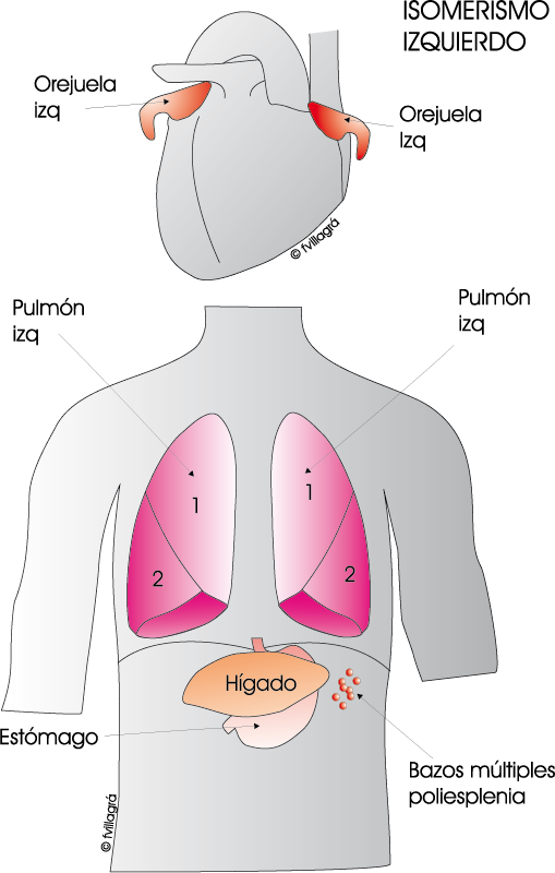 Tulžies takų klasifikacijos ligos - Hepatitas