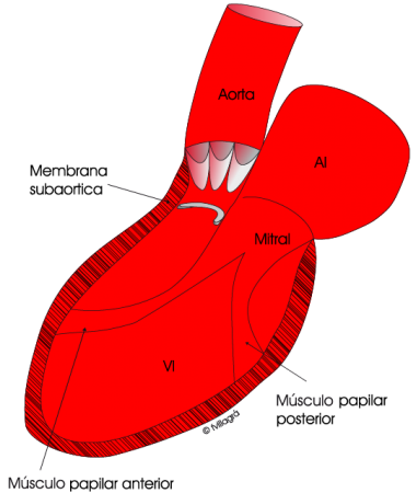 2.10.-estenosissubaortica.b.1