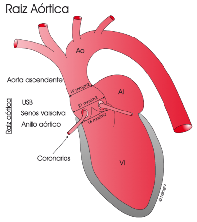 2.9.-raiz-aortica-normal.a.1