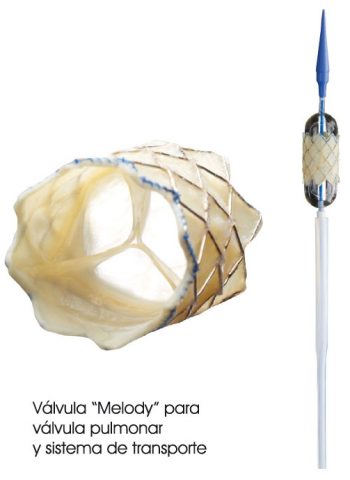 4.5.4.-valvula-melody-y-sistema-transporte